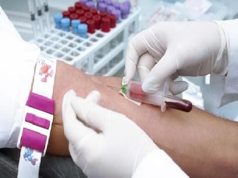 only giving user charge patient can take platelets